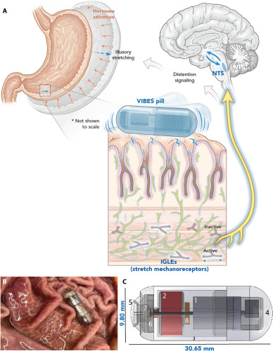 (A) The Vibrating Ingestible BioElectronic Stimulator (VIBES) makes contact with the gastric lining and activates following contact with gastric fluid. Vibrations activate intraganglionic laminar endings (IGLEs) in the celiac plexus, signaling distension to the NTS, which interacts with hunger circuitry to signal illusory distension. (B) VIBES sits among gastric rugae in a swine stomach and strokes the mucosa as it performs stimulation. (C) The VIBES pill consists of an (1) offset motor, (2) silver oxide battery, (3) central body, (4) motor cap, (5) pill cap, (6) pogo pin, (7) gelatinous membrane, and (8) resistor. Original illustration by V. Fulford.